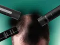 Tre flaconi di fibre di cheratina per capelli fluttuano sopra una testa con capelli diradati, suggerendo una soluzione per infoltire.