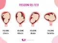 Illustrazione mostra le posizioni del feto: cefalica, podalica, obliqua e trasversa. La posizione podalica è quella in cui il bambino è seduto, con i piedi verso il basso.