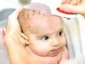 Mani delicate rimuovono la crosta lattea dal cuoio capelluto di un neonato con un pettinino bianco e rosso.