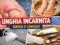 Unghia incarnita: rimedi a casa con pediluvio, cotone e kit per la cura.