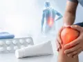 Uomo con dolore al ginocchio, blister di dicloreum compresse e tubo di crema.