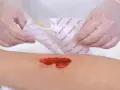 Mani guantate applicano una medicazione su una ferita aperta, un passo importante per imparare come cicatrizzare una ferita velocemente.