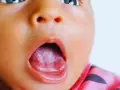 Primo piano del volto di un neonato con la bocca aperta, mostrando il palato bianco e la lingua rosa.