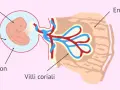 Feto nella cavità amniotica, collegato ai villi coriali nell'endometrio. Il sacco vitellino senza embrione è visibile.