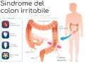 Sintomi del colon irritabile: dolore addominale, gas, diarrea/stipsi e muco. Il colon è evidenziato in un corpo umano.