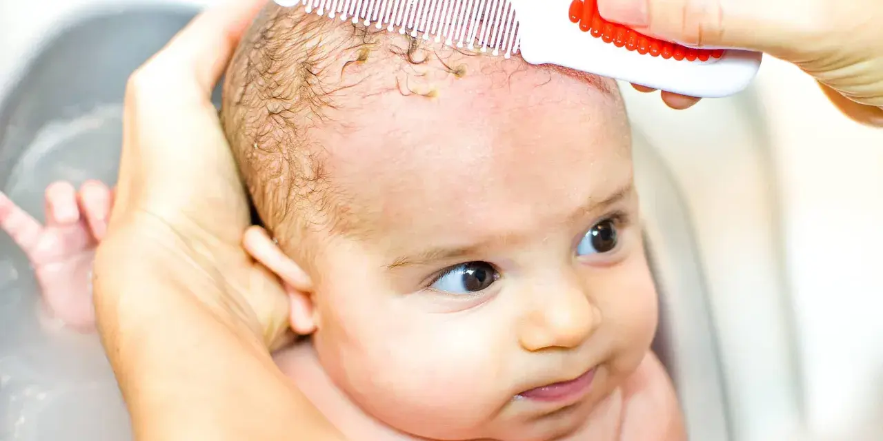 Mani delicate rimuovono la crosta lattea dal cuoio capelluto di un neonato con un pettinino bianco e rosso.