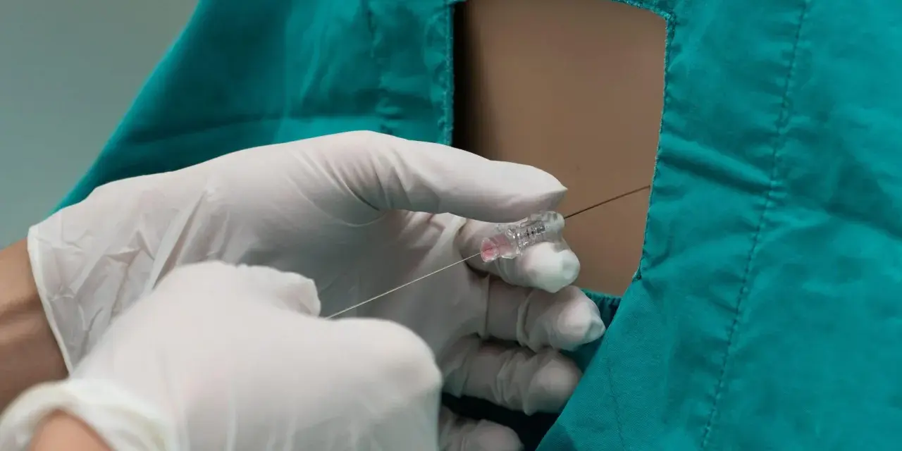 Mani guantate eseguono un'iniezione epidurale, sollevando interrogativi sugli epidurale effetti collaterali a lungo termine.