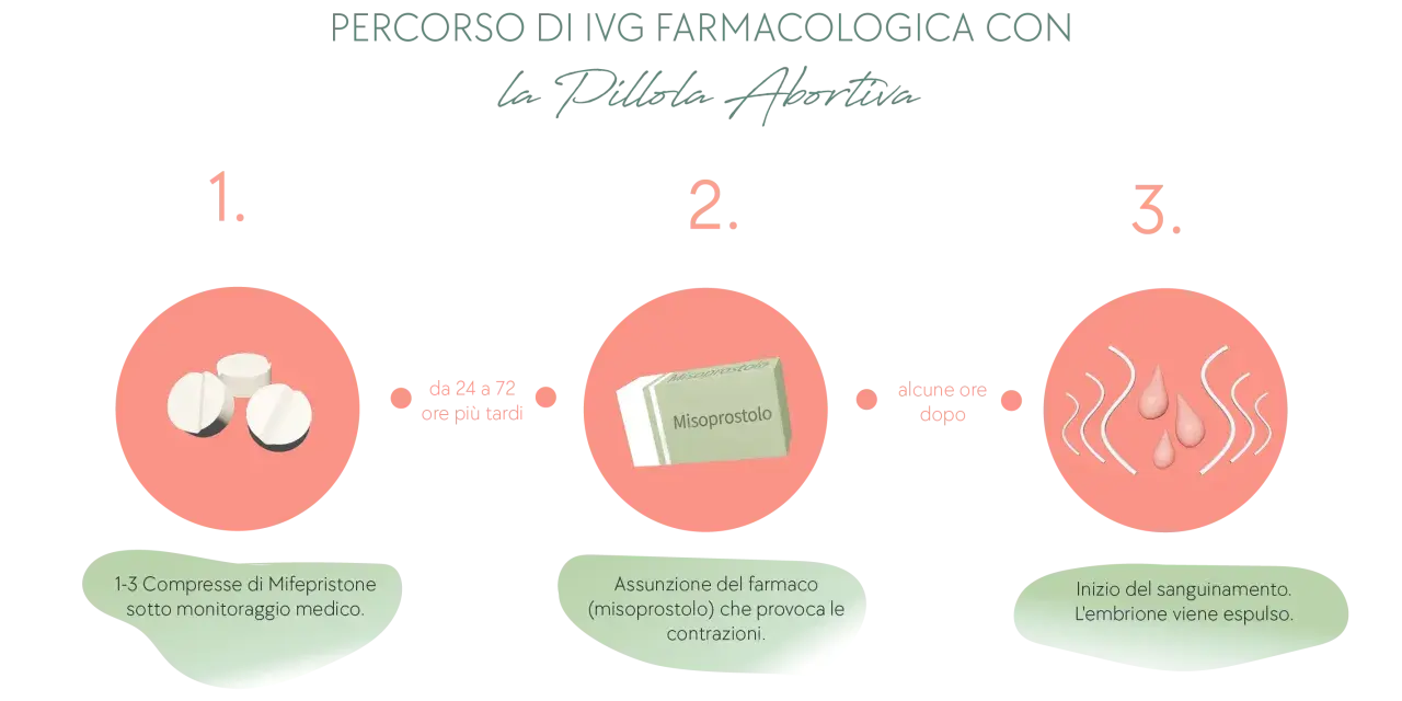 Percorso IVG farmacologica: 1. Mifepristone sotto controllo medico. 2. Assunzione di Misoprostolo per contrazioni. 3. Inizio sanguinamento, espulsione embrione. La pillola abortiva è un processo in tre fasi.