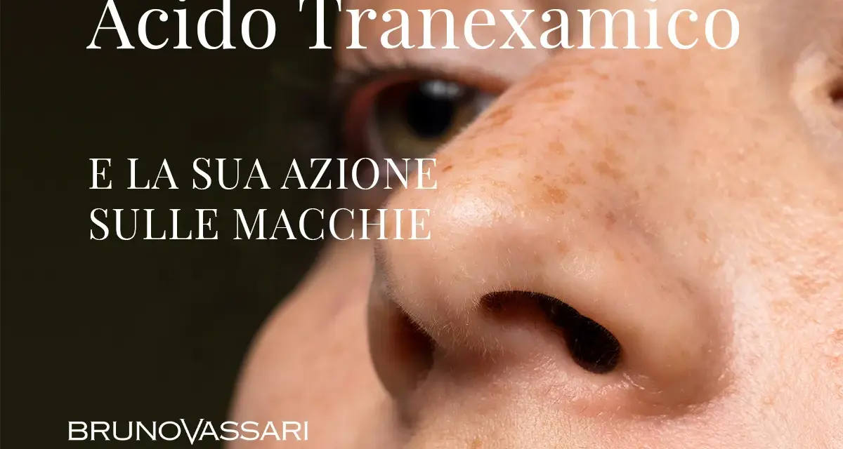 Acido Tranexamico: la sua azione sulle macchie. Bruno Vassari.