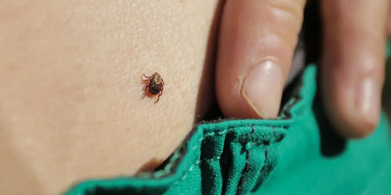 Una zecca è attaccata alla pelle, vicino a un lembo di tessuto verde. La puntura di zecca è un rischio da non sottovalutare.