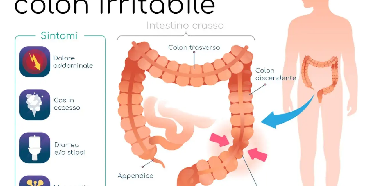 Sintomi del colon irritabile: dolore addominale, gas, diarrea/stipsi e muco. Il colon è evidenziato in un corpo umano.