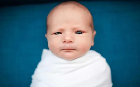 Primo piano di un neonato avvolto in una coperta bianca. La sua testa è quasi calva, mostrando una leggera perdita capelli neonato, tipica dei primi mesi.