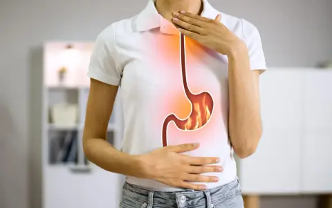 Persona con bruciore di stomaco, immagine di un esofago e stomaco infuocati. Potrebbe essere utile omeprazen 20 mg.