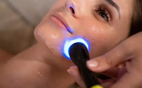 Primo piano del viso di una donna durante un trattamento di biorivitalizzazione con luce blu.