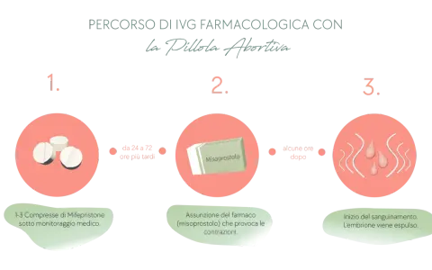 Percorso IVG farmacologica: 1. Mifepristone sotto controllo medico. 2. Assunzione di Misoprostolo per contrazioni. 3. Inizio sanguinamento, espulsione embrione. La pillola abortiva è un processo in tre fasi.