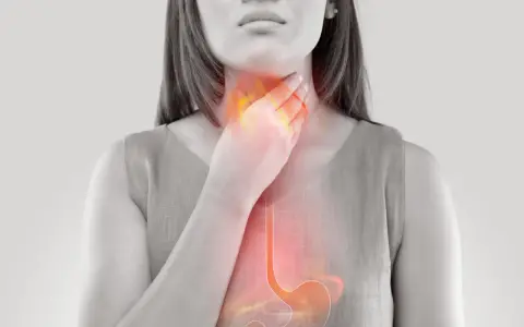 Donna con mano alla gola, evidenziata un'area infiammata che si estende allo stomaco, suggerendo bruciore o reflusso acido, come nel caso di **pantorc 20**.