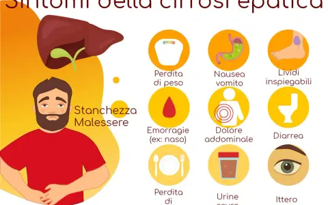 Sintomi della cirrosi epatica: stanchezza, perdita di peso, nausea, emorragie, dolore addominale, lividi, ittero e altri.