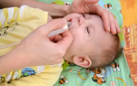 Mano che usa un aspiratore nasale su un neonato con naso chiuso senza muco.