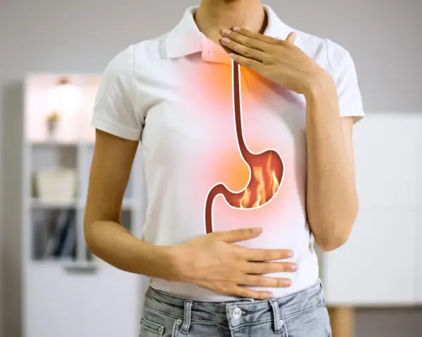 Persona con bruciore di stomaco, immagine di un esofago e stomaco infuocati. Potrebbe essere utile omeprazen 20 mg.