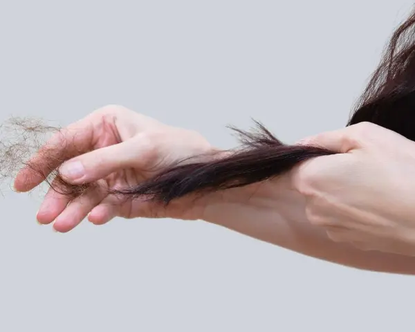Mani che mostrano perdita capelli allattamento, cercando rimedi naturali per rinforzare i capelli indeboliti.