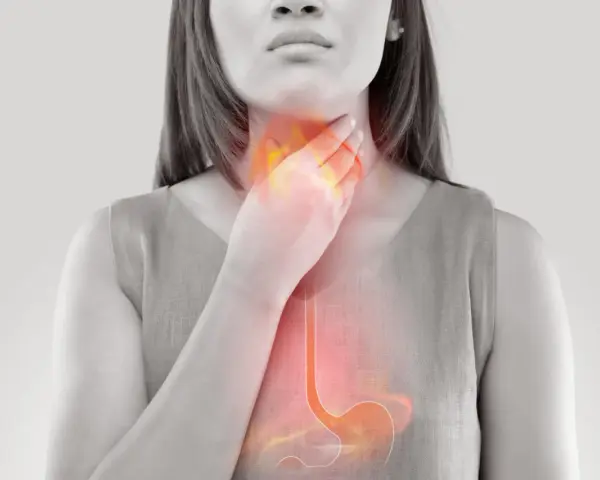 Donna con mano alla gola, evidenziata un'area infiammata che si estende allo stomaco, suggerendo bruciore o reflusso acido, come nel caso di **pantorc 20**.