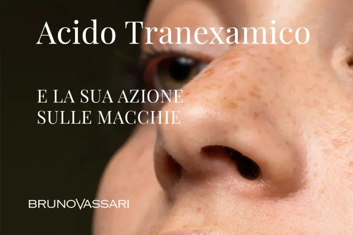 Acido Tranexamico: la sua azione sulle macchie. Bruno Vassari.