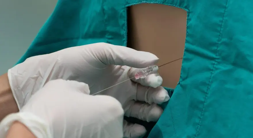 Mani guantate eseguono un'iniezione epidurale, sollevando interrogativi sugli epidurale effetti collaterali a lungo termine.