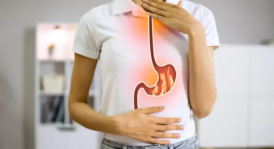 Persona con bruciore di stomaco, immagine di un esofago e stomaco infuocati. Potrebbe essere utile omeprazen 20 mg.