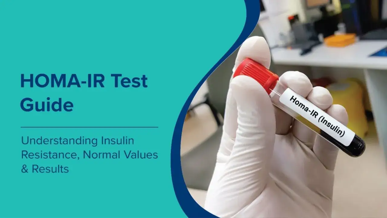 Guida al test HOMA-IR per comprendere l'insulino resistenza. Un campione di sangue etichettato 