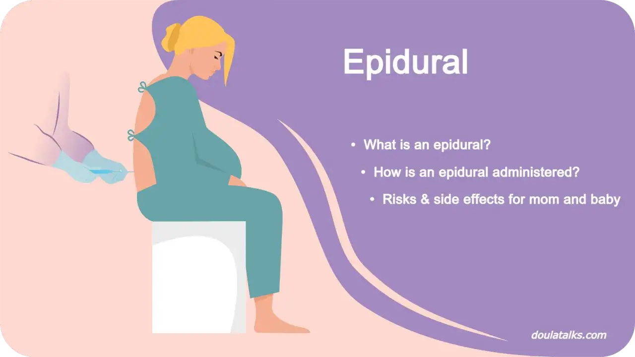 Illustrazione di un'epidurale: una donna incinta riceve un'iniezione. Si discute dei rischi e degli epidurale effetti collaterali a lungo termine.