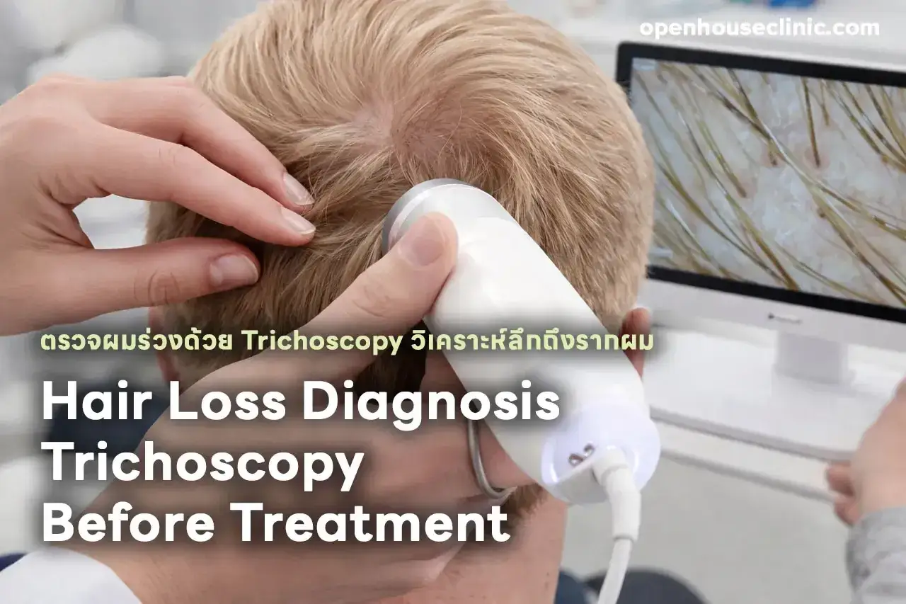 Diagnosi di alopecia androgenetica con tricoscopia per valutare la perdita di capelli prima del trattamento.