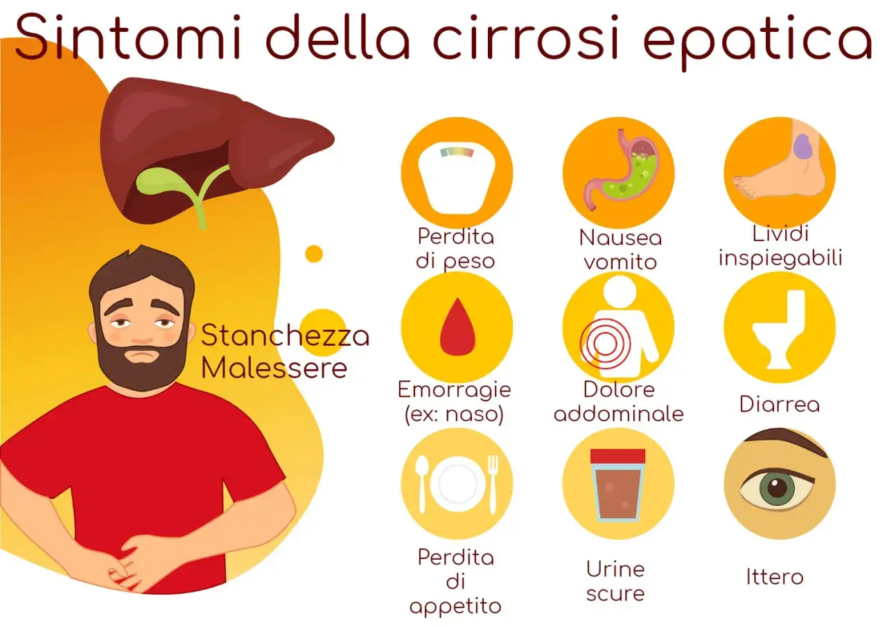 Illustrazione dei sintomi della cirrosi epatica: stanchezza, perdita di peso, nausea, lividi, emorragie, dolore addominale, diarrea, perdita di appetito, urine scure e ittero.