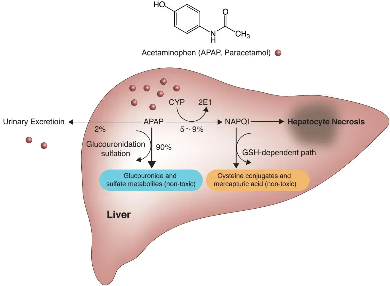 Schema del fegato che mostra il metabolismo del paracetamolo (Tachipirina). La maggior parte viene convertita in metaboliti non tossici, ma una piccola parte pu&ograve; causare necrosi epatica.