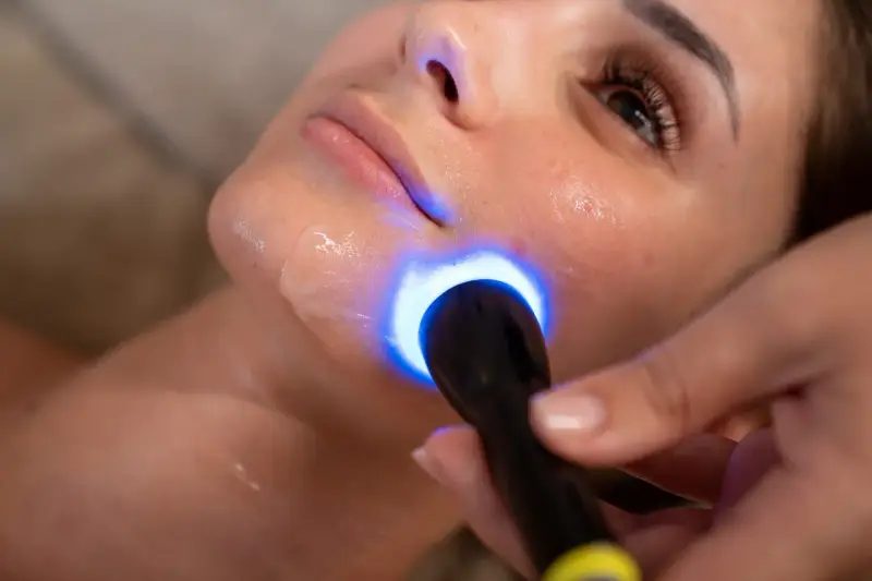 Primo piano del viso di una donna durante un trattamento di biorivitalizzazione con luce blu.
